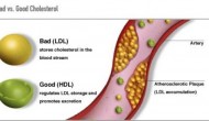 IMPROVE-IT印证特定区间内LDL-C越低越好，称胆固醇原则（LDL Principle）为时尚早