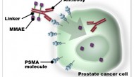 Progenics制药公司报道抗体药物偶联物PSMA ADC的积极临床结果