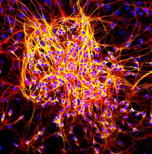 MAP2-tau_in_neurons
