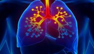 阿斯列康IL5受体抗体哮喘三期临床达到一级终点
