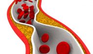 四两拨千斤：PCSK9 siRNA显示长期疗效