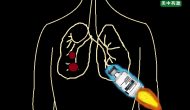 Keytruda又一次领先，获批一线治疗PD-L1高表达晚期非小细胞肺癌（NSCLC）