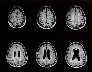 msmri101_882378