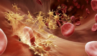 FDA批准血友病新药emicizumab